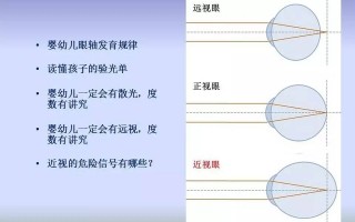 散光轴度一般是多少度，散光轴位一般是多少